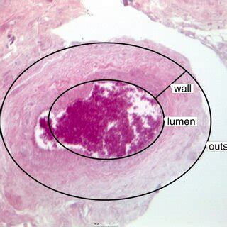 Histology of the arterial vessel showing the size of the lumen compared ...