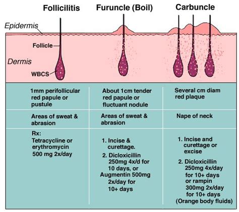 boil medications - pictures, photos