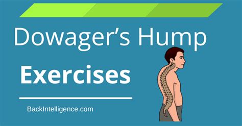 How To Fix Dowager’s Hump - Causes, Symptoms, Exercises