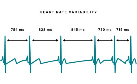 Runbook de um gajo que mudou de vida: HRV - O que nos diz o nosso coração