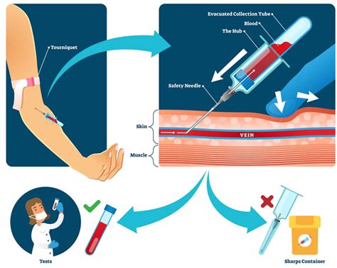 Learning Phlebotomy Equipment | Arizona College