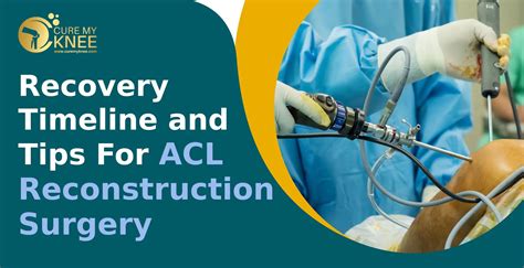 Recovery Timeline and Tips For ACL Reconstruction Surgery