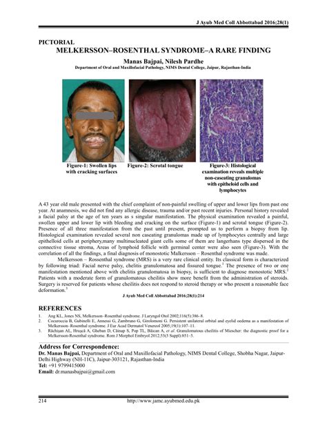 (PDF) MELKERSSON–ROSENTHAL SYNDROME–A RARE FINDING