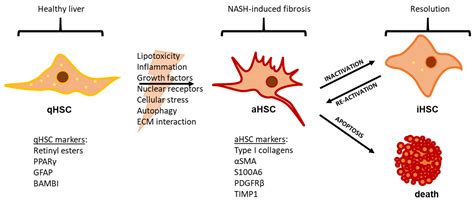 Biomedicines | Free Full-Text | Hepatic Stellate Cell Activation and ...