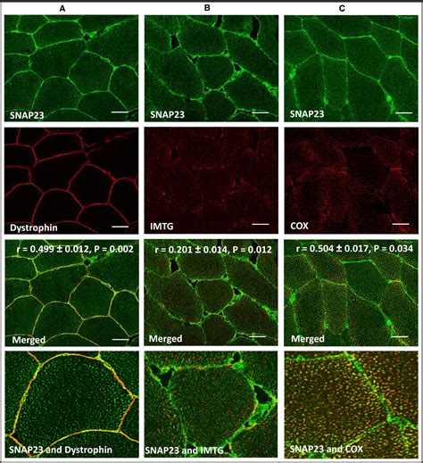 Immunofluorescence microscopy of SNAP23 in human skeletal muscle reveals colocalization with ...