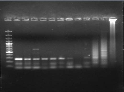 What´s a dimer primer? If my PCR product is aprox. 640pb and...