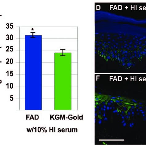 Expression of keratinocyte differentiation markers. (A-L) Eight micron ...