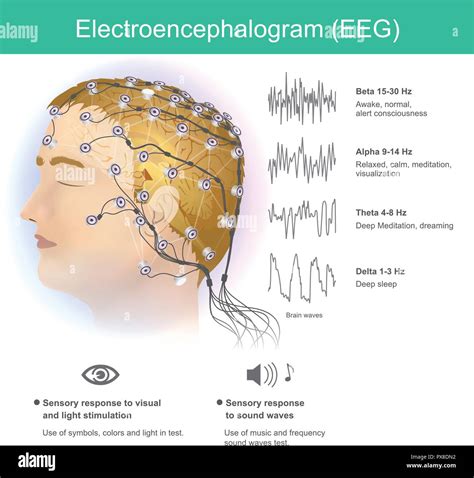 Eeg electrode placement Stock Vector Images - Alamy