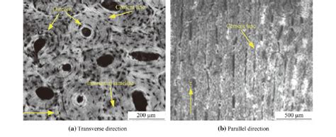 Micrographs of cortical bone in different directions [25] | Download ...