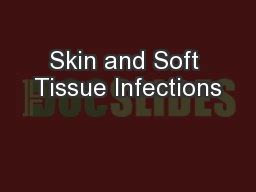 Skin and Soft Tissue Infections