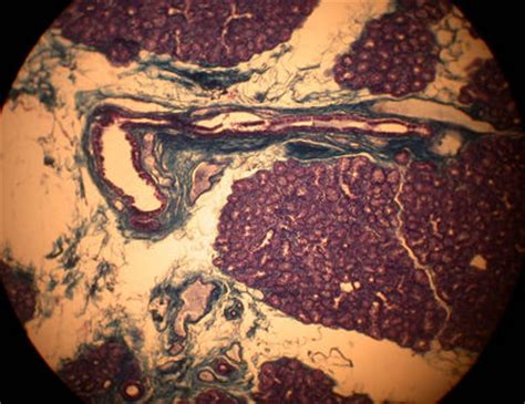 Eye Histology - Lacrimal gland - histology slide