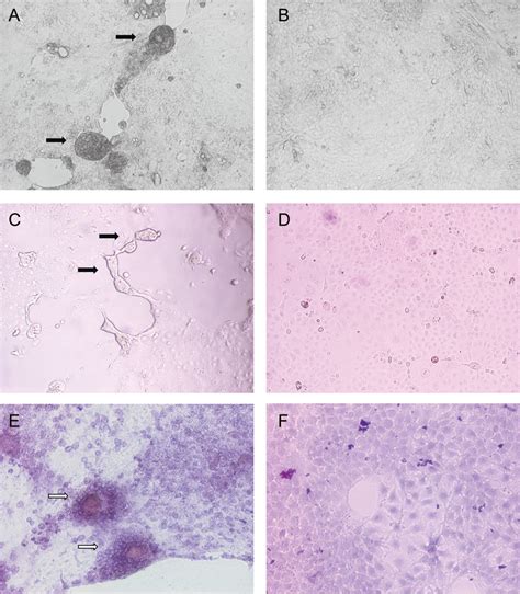 Cytopathic effects of cell rounding, detachment, and syncytia formation... | Download Scientific ...