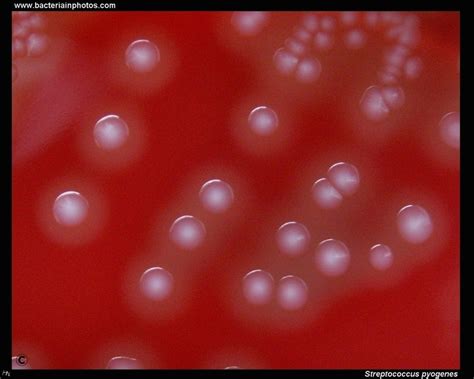 Streptococcus pyogenes colonies on blood agar