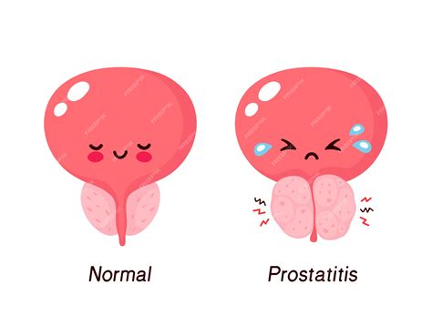 Premium Vector | Normal prostate and benign prostatic hyperplasia. Cute ...