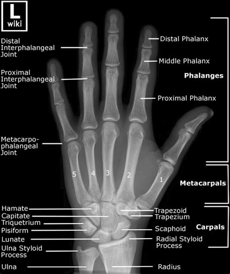 Radiographic Anatomy of the Hand | RADIOLOGYPICS.COM