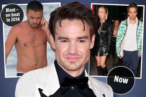 The mystery of Liam Payne's new chiselled jaw and sharp cheekbones ...