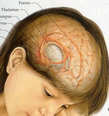 Brain Cancer - Sign and Symptoms - Your Health