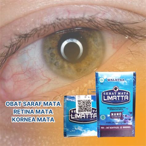 Jual Obat Retina Mata Rusak - Mata Berkabut - Buram - Ulkus Kornea Mata ...