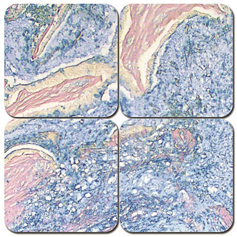 Colloidal Iron Stain Kit