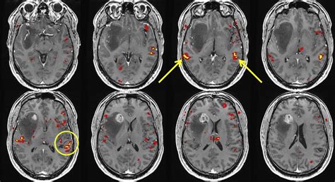 Functional Brain Anatomy | Radiology Key