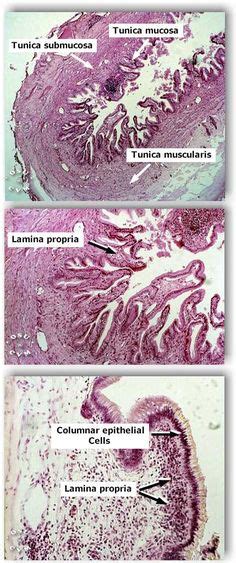 Gallbladder histology Science Notes, Medical Science, Science Ideas, Pa ...