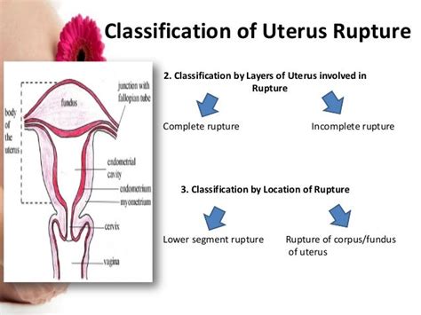 BIRTH CANAL TRAUMA AND UTERUS RUPTURE