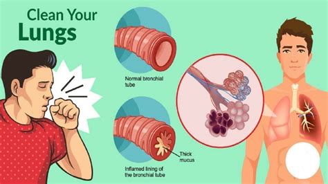 How to Get Rid of Phlegm and Mucus in Chest & Throat (Instant Result) - YouTube