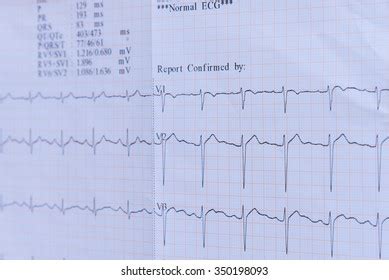 Selective Focus Electrocardiogram Ecg Ekg Report Stock Photo 350198093 | Shutterstock