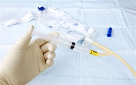 How to Flush Supra Pubic Catheter in 15 Effortless Steps?