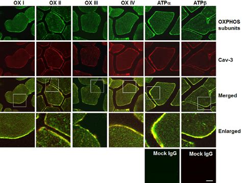 A portion of OXPHOS complexes is co-localized with caveolin-3 in the ...