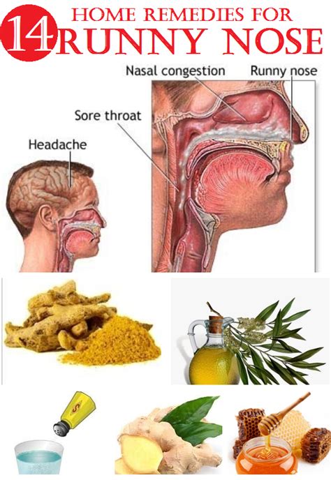 Pin by Lindsey Johnson on ! " A-Z about Herbal Medicine and Home Remedies " | Remedies, Home ...