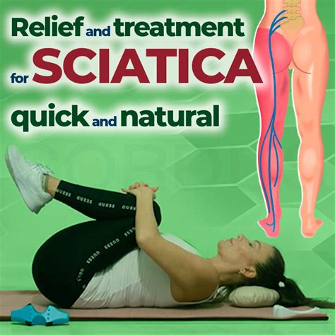 Relief and treatment for sciatica quick and natural - Cordus United States
