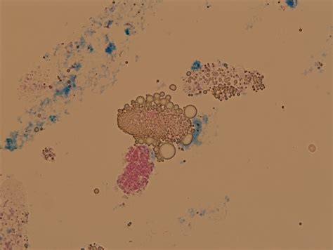 Microscopic Analysis of Urine | Faculty of Medicine, Masaryk University