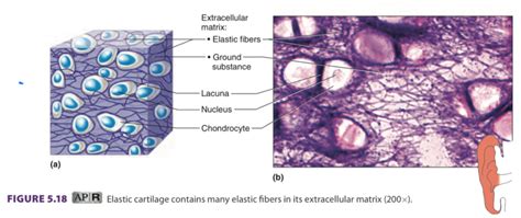 Elastic Cartilage Diagram | Quizlet