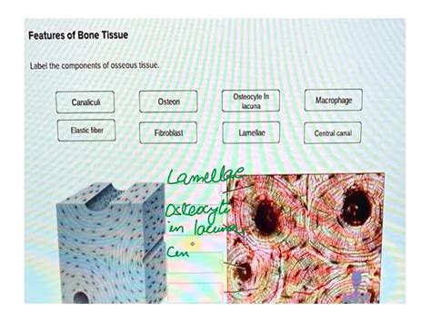 SOLVED: Features of Bone Tissue Label the components of osseous tissue. Canaliculi Osteon ...