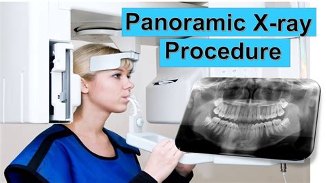 Panoramic Dental X-Ray Procedure EXPLAINED | PANORAMIC XRAY | Panoramic ...