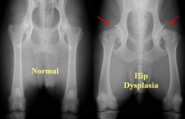 Hip Dysplasia In Dogs Surgery