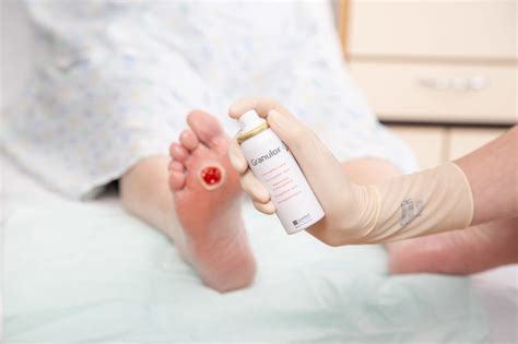 Thousands of diabetic foot ulcer patients could benefit from topical oxygen therapy with updated ...