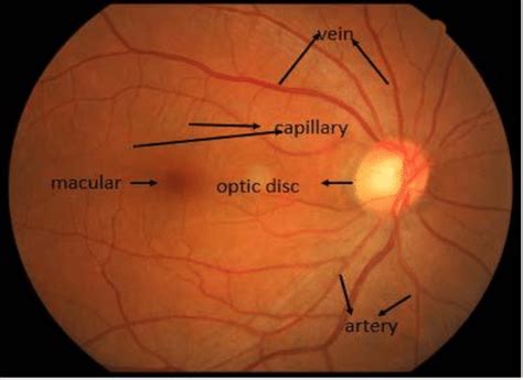 Internal Overview of Normal Eye (X-Ray) | Download Scientific Diagram