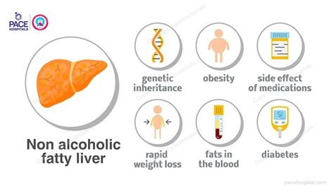 Non Alcoholic Fatty Liver Disease Causes Symptoms And Treatments