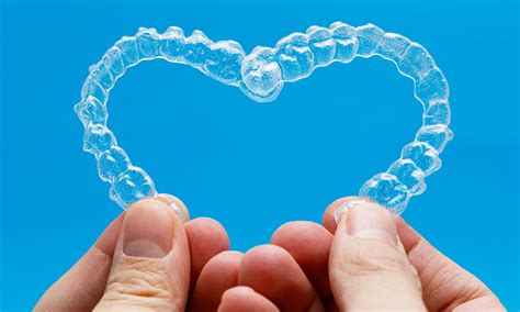 The Benefits of SureSmile® Clear Aligner Therapy For Your Perfect Smile