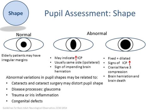 Image result for pupil assessment | Cranial nerve 3, Cranial nerves, Abnormal