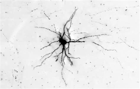 Visual Cortex Neuron – Webvision