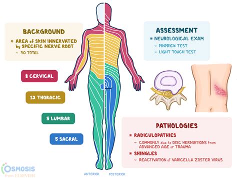 Dermatomes: What Are They, Related Diseases, and More | Osmosis