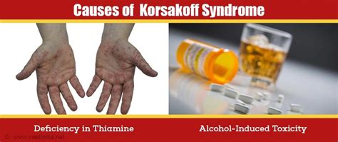 Korsakoff Syndrome - Causes, Symptoms, Diagnosis, Treatment & Prevention