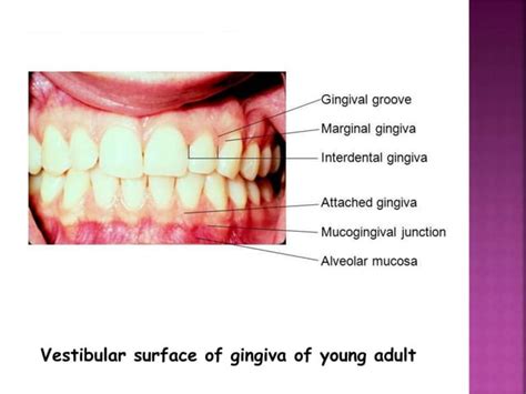 Histology of Gingiva