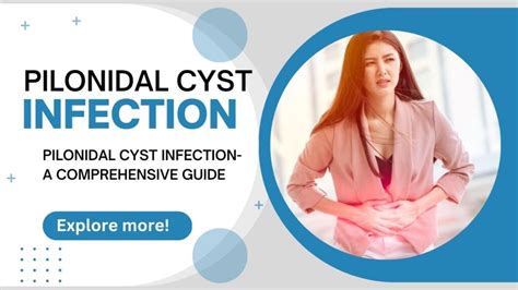 Pilonidal cyst infection – Latest Tech Portal