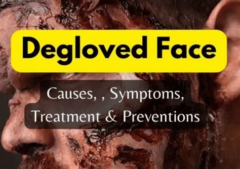 Degloved Face: Understanding the Causes, Impacts and Recovery