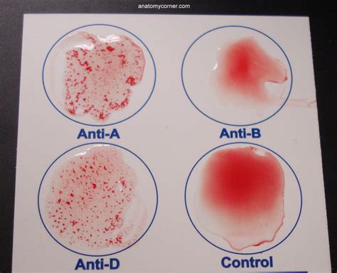 Practice Problems: Genetics and Blood Types