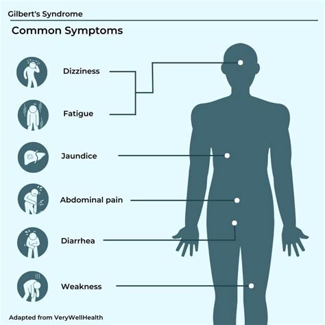 Is Gilbert's Syndrome An Autoimmune Disease?